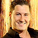 Val Chmerkovskiy Took Stitches 'Like a Champ,' Says His Plastic Surgeon