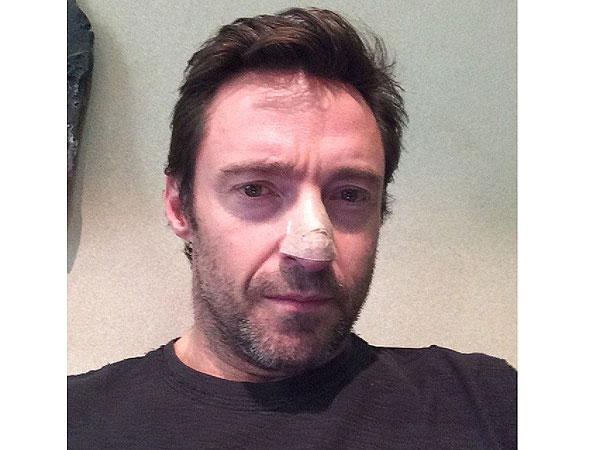 Hugh Jackman Treated for Skin Cancer