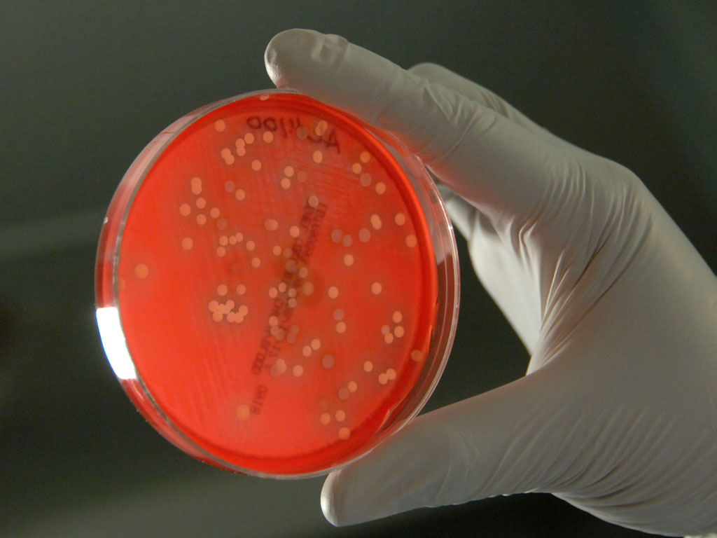 Centers for Disease Control and Prevention Investigates Elizabethkingia